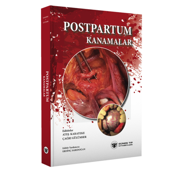 Postpartum Kanamalar